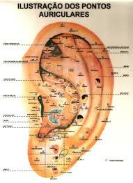 Auriculoterapia